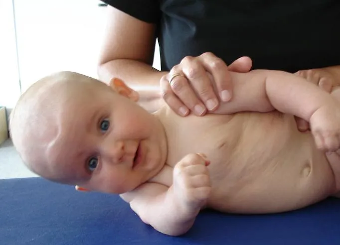 Baby wird nach Vojta behandelt